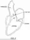 Fig. 02 - SURGICAL SYSTEM FOR A HEART VALVE