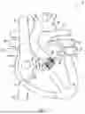 Fig. 02 - METHODS AND DEVICES FOR DELIVERY OF A PROSTHETIC VALVE