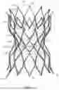 Fig. 04 - DELIVERY APPARATUS AND METHODS FOR IMPLANTING PROSTHETIC DEVICES