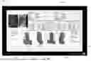 Fig. 08 - SYSTEM FOR EDGE CASE PATHOLOGY IDENTIFICATION AND IMPLANT MANUFACTURING
