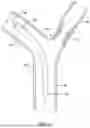 Fig. 02 - STENT SYSTEM FOR MAINTAINING PATENCY OF A BODY LUMEN