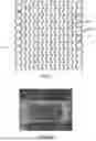 Fig. 02 - BIODEGRADABLE ENDOPROSTHESES AND METHODS OF THEIR FABRICATION