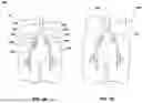 Fig. 02 - PROXIMAL STENT-GRAFT RETENTION SYSTEM