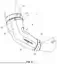 Fig. 06 - ANATOMICAL BRACE FOR DYNAMICALLY STABILIZING THE ELBOW