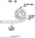 Fig. 05 - ADVANCED COCHLEA ACCESS