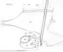 Fig. 16 - ADVANCED COCHLEA ACCESS