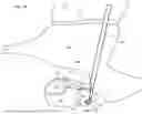 Fig. 43 - ADVANCED COCHLEA ACCESS