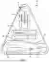 Fig. 02 - Urinary Catheter-Insertion Kits with Integrated Instructions for Use and Methods Thereof
