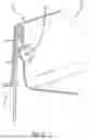 Fig. 10 - Urinary Catheter-Insertion Kits with Integrated Instructions for Use and Methods Thereof