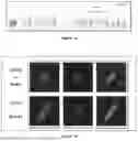 Fig. 02 - COMPOSITION FOR TREATING DYSFERLINOPATHY