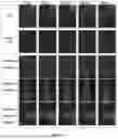 Fig. 06 - COMPOSITION FOR TREATING DYSFERLINOPATHY