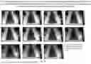 Fig. 16 - PLATFORM TECHNOLOGY FOR TREATMENT OF INFLAMMATORY, IMMUNOLOGICAL AND/OR AUTOIMMUNOLOGICAL DISEASES