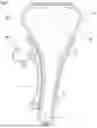 Fig. 02 - TENSIONER