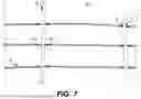 Fig. 07 - DEVICE AND METHOD FOR ELIMINATION OF A LEAK IDENTIFIED IN AN EXPANSION JOINT OF A GAS PIPE IN OPERATION