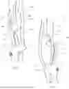 Fig. 09 - Archery Bow Riser and Related Apparatuses