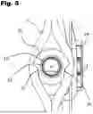 Fig. 06 - ADJUSTABLE APERTURE AXIS PEEP SIGHT DEVICE