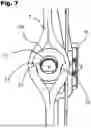 Fig. 08 - ADJUSTABLE APERTURE AXIS PEEP SIGHT DEVICE