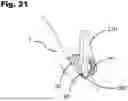 Fig. 22 - ADJUSTABLE APERTURE AXIS PEEP SIGHT DEVICE