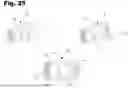 Fig. 26 - ADJUSTABLE APERTURE AXIS PEEP SIGHT DEVICE