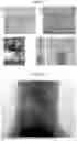 Fig. 02 - X-RAY CONTRAST MEDIUM AND X-RAY IMAGE ACQUISITION METHOD