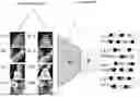 Fig. 01 - QUANTIFICATION OF BODY COMPOSITION USING CONTRASTIVE LEARNING IN CT IMAGES