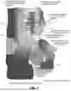 Fig. 10 - SYSTEMS, DEVICES, AND METHODS FOR NON-INVASIVE IMAGE-BASED PLAQUE ANALYSIS AND RISK DETERMINATION