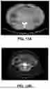 Fig. 21 - SYSTEMS, DEVICES, AND METHODS FOR NON-INVASIVE IMAGE-BASED PLAQUE ANALYSIS AND RISK DETERMINATION
