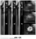 Fig. 22 - SYSTEMS, DEVICES, AND METHODS FOR NON-INVASIVE IMAGE-BASED PLAQUE ANALYSIS AND RISK DETERMINATION