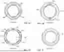 Fig. 04 - THROMBUS REMOVAL SYSTEMS AND ASSOCIATED METHODS