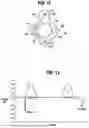 Fig. 09 - SMART VALVED HOLDING CHAMBER
