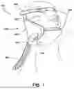Fig. 02 - AIR DELIVERY CONDUIT