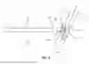 Fig. 10 - Arterial sheath which allows distal perfusion within a cannulated vessel