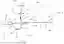 Fig. 02 - Balloon Catheter