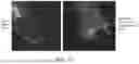 Fig. 16 - METHODS FOR BETTER DELIVERY OF ACTIVE AGENTS TO TUMORS