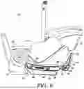 Fig. 09 - INFANT TRANSPORT SYSTEM AND ASSEMBLY
