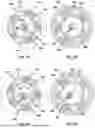 Fig. 06 - CONTINUOUSLY VARIABLE TRANSMISSION UNIT, PREFERABLY FOR A BICYCLE