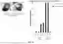 Fig. 17 - RE-AGGREGATION OF STEM CELL-DERIVED PANCREATIC BETA CELLS
