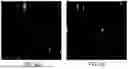 Fig. 11 - MACHINE LEARNING SYSTEMS AND METHODS FOR IDENTIFYING AND CLASSIFYING RARE CELLS