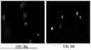 Fig. 15 - MACHINE LEARNING SYSTEMS AND METHODS FOR IDENTIFYING AND CLASSIFYING RARE CELLS