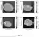 Fig. 04 - ION FOCUSING AND MANIPULATION