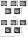 Fig. 09 - ION FOCUSING AND MANIPULATION