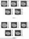 Fig. 12 - ION FOCUSING AND MANIPULATION