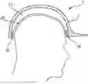 Fig. 01 - HELMET