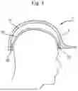 Fig. 02 - HELMET