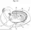 Fig. 09 - HELMET