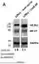 Fig. 28 - METHODS AND COMPOSITIONS RELATING TO STEROID HORMONE RECEPTOR-DEPENDENT PROLIFERATIVE DISORDERS
