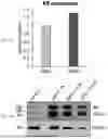 Fig. 32 - METHODS AND COMPOSITIONS RELATING TO STEROID HORMONE RECEPTOR-DEPENDENT PROLIFERATIVE DISORDERS