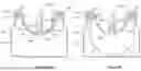 Fig. 04 - INFUSION PUMP FLOW RATE CONTROL