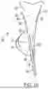 Fig. 11 - UTENSIL