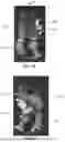 Fig. 07 - COMBINATIONS FOR ALLERGY THERAPY